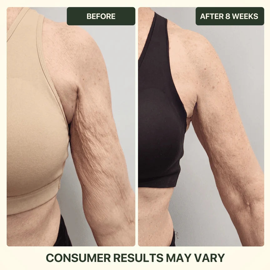 1. It visibly firms and smooths the look of crepey skin.