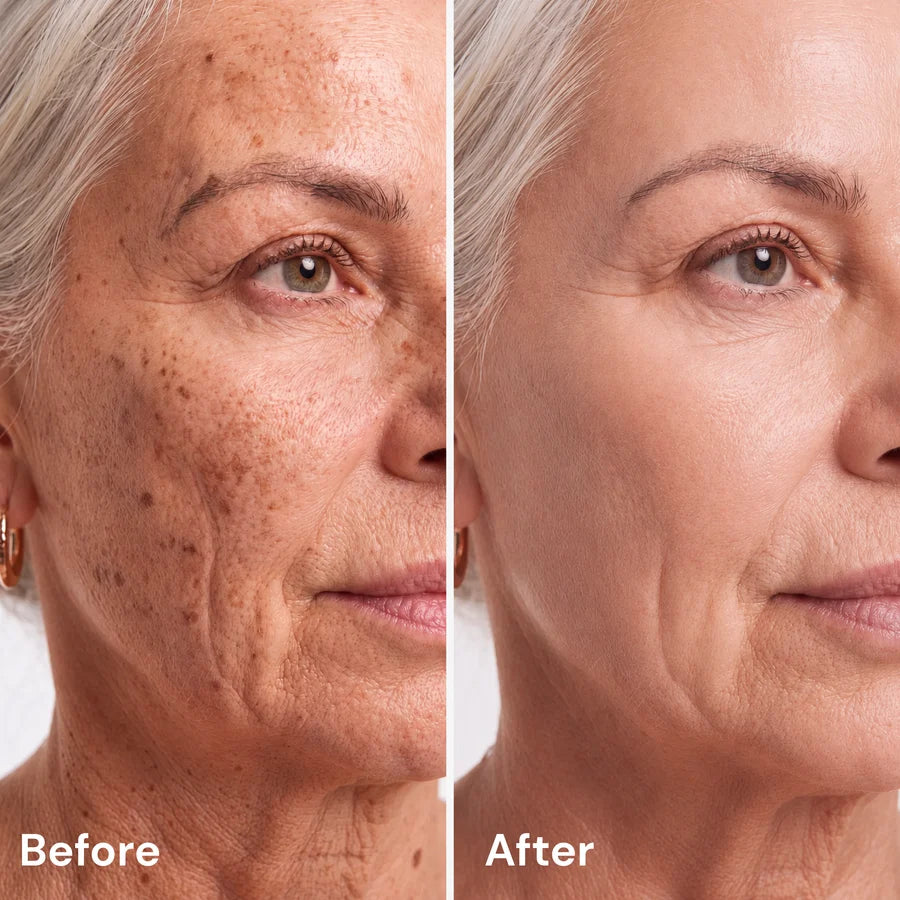 Fades Dark Spots & Old Scars