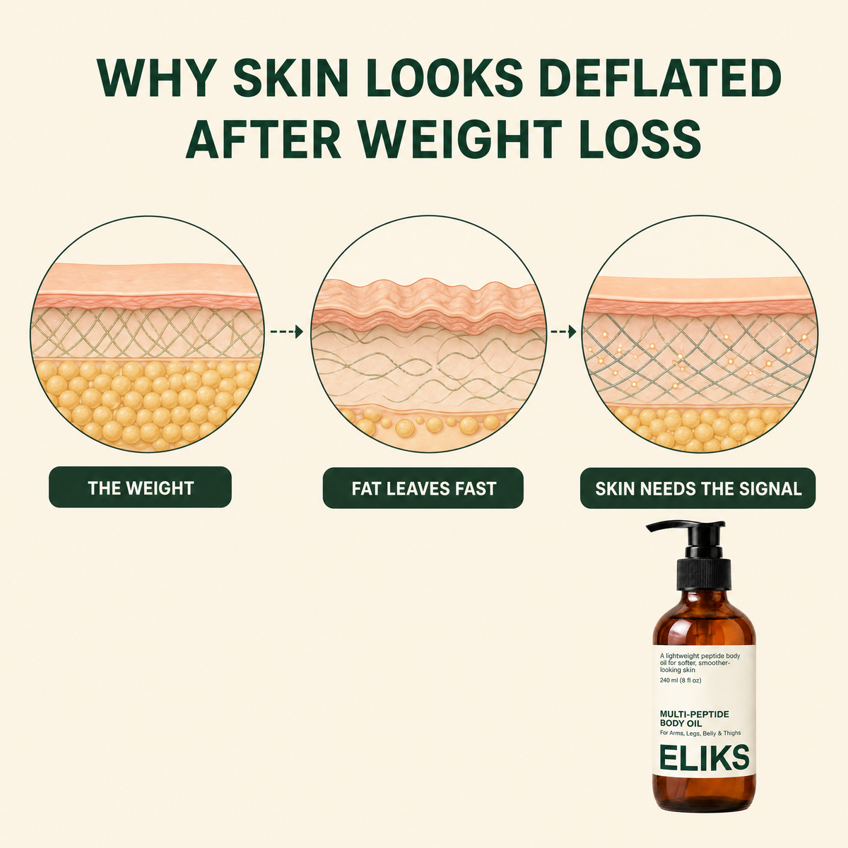 1. Your skin didn't get the memo when the weight came off.